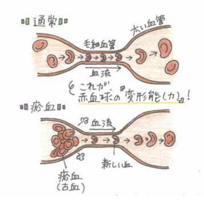 血管断面イメージ